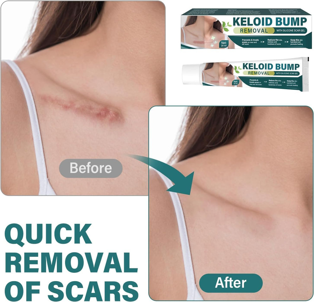 NOBA Keloid Bump Removal massage application on skin