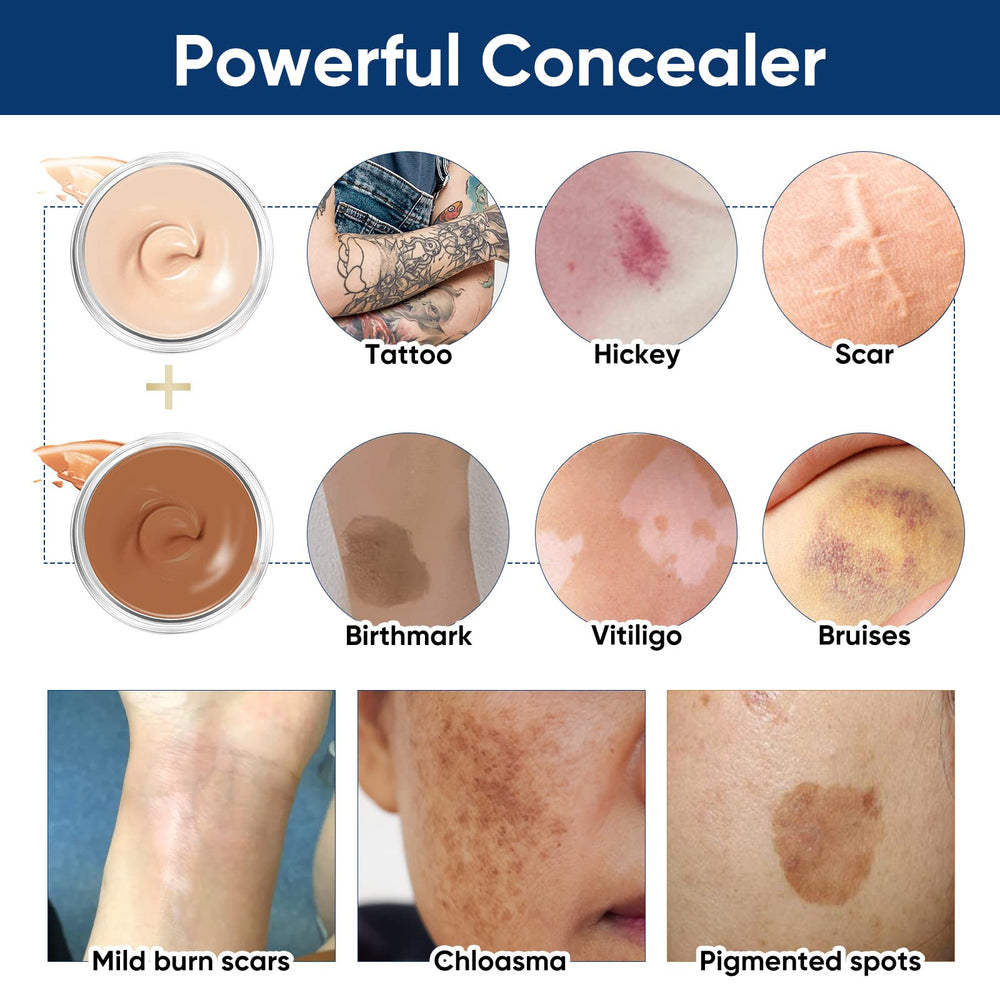 NOBA Tattoo Cover Up skin-blemish concealment for tattoos, scars, and spots