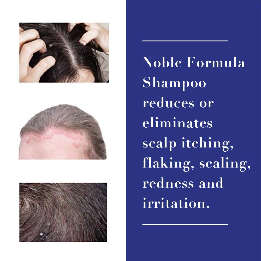 Close-up of Noble Formula label emphasizing 2% pyrithione zinc shampoo.