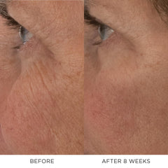 Noble Panacea glycolic acid exfoliation close-up for smoother skin