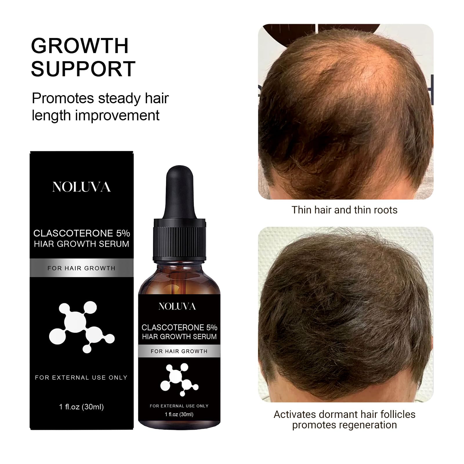 NOLUVA hair growth preview suggesting thicker, healthier strands