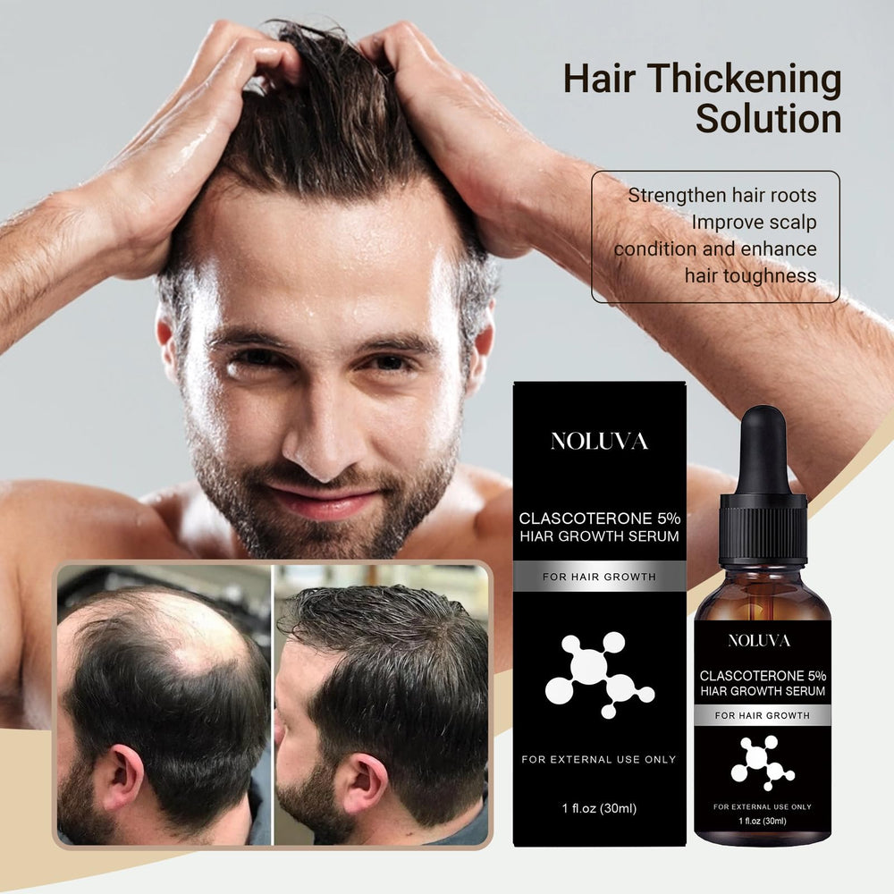 NOLUVA premium packaging box shown for discreet hair restoration at home