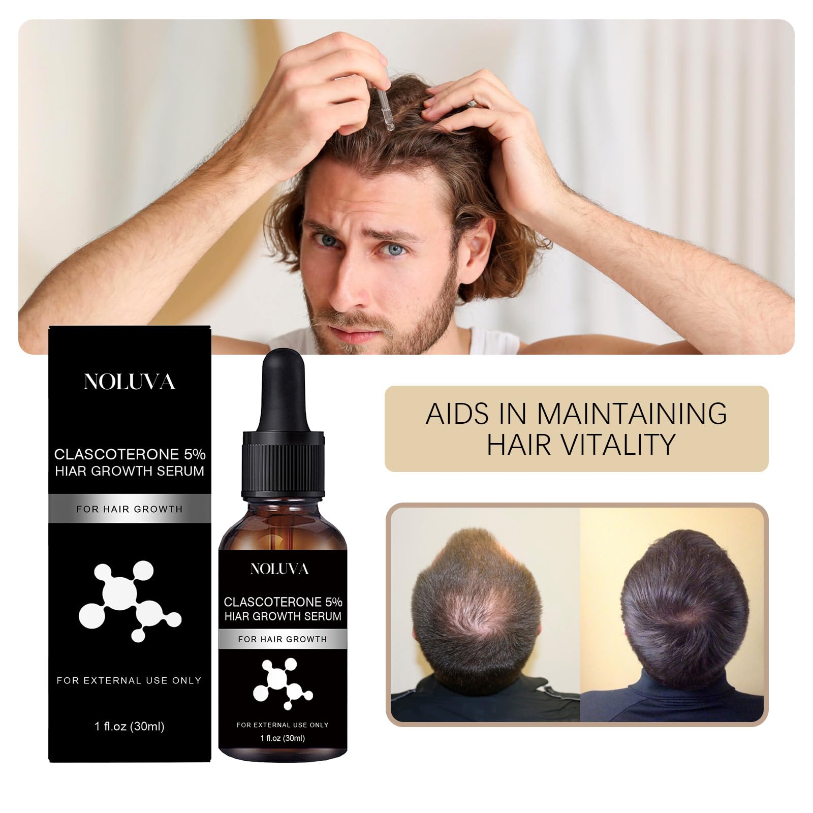NOLUVA scalp application shows even serum distribution