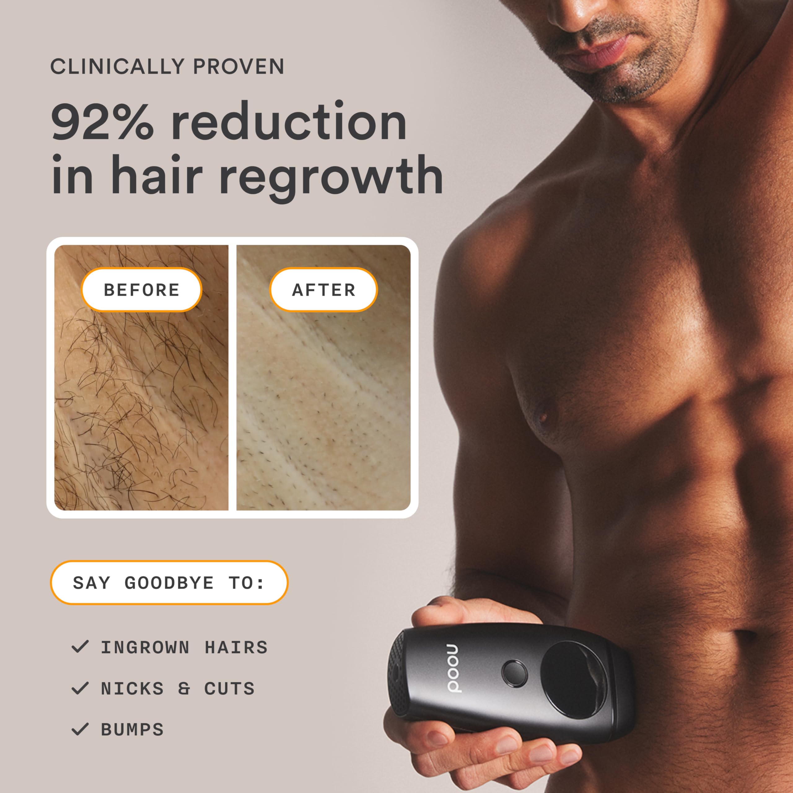 Nood Shaving Starter Kit with refillable razor for smoother post-IPL touch-ups.