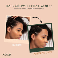 NOOR HAIR Growth Serum application on the hand demonstrates a simple daily routine.