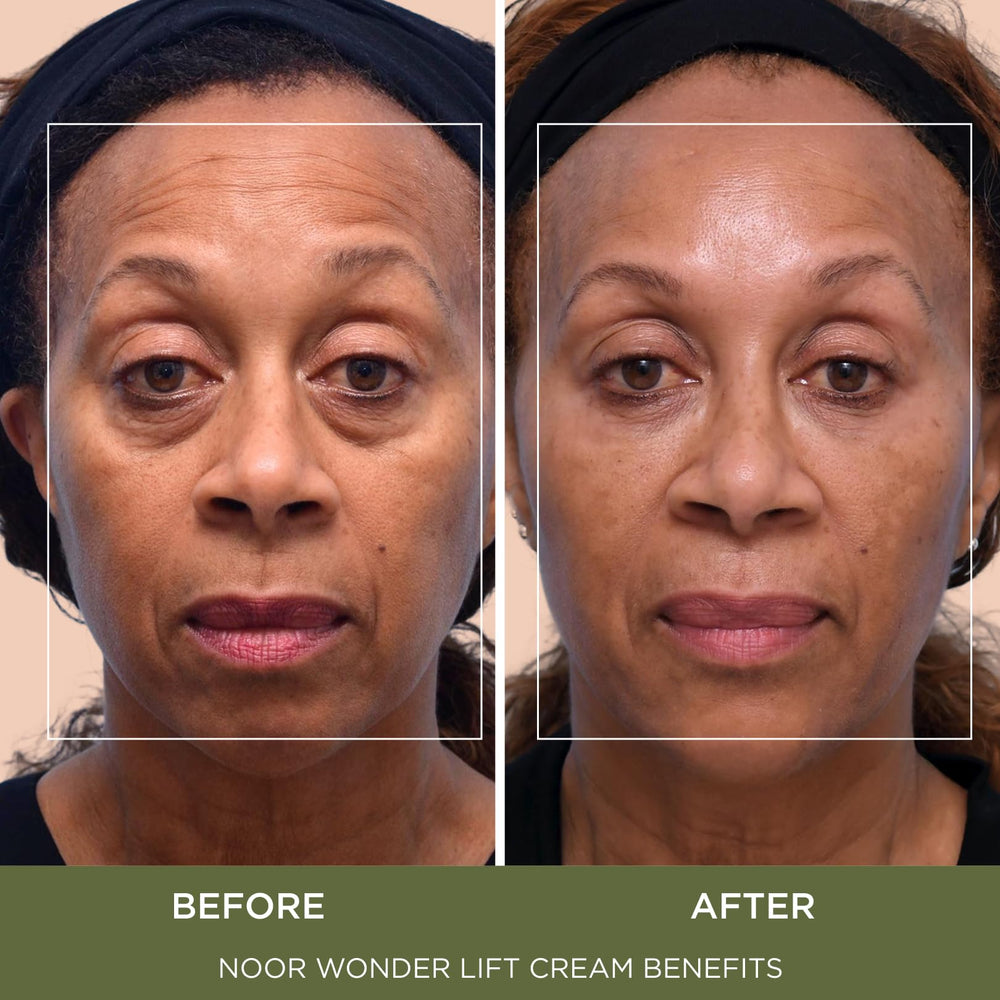 Noor Hair Wonder Lift Cream application on skin shows quick absorption and smooth finish.