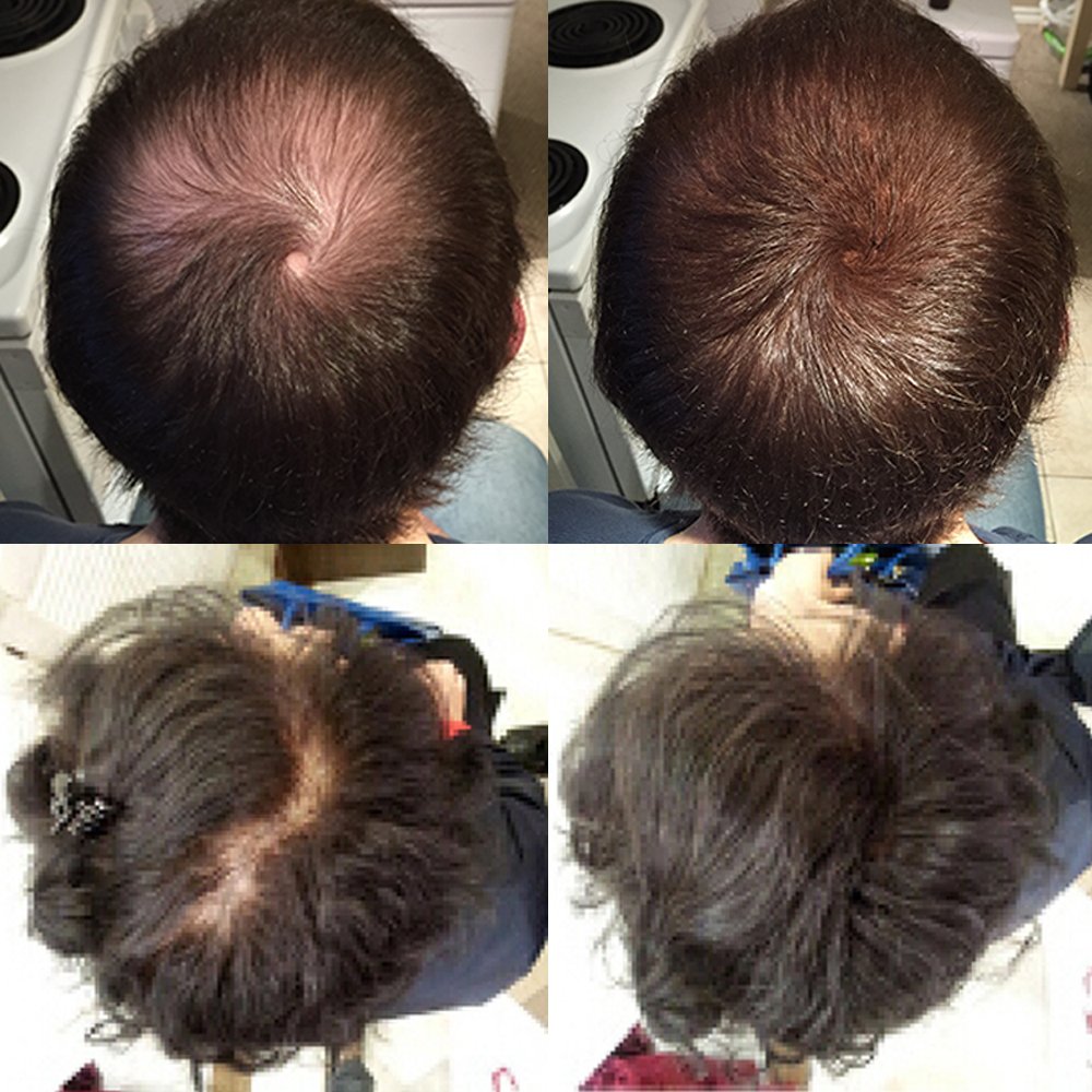 Nor1 Keratin Hair Fibers application close-up showing easy use on thinning spots