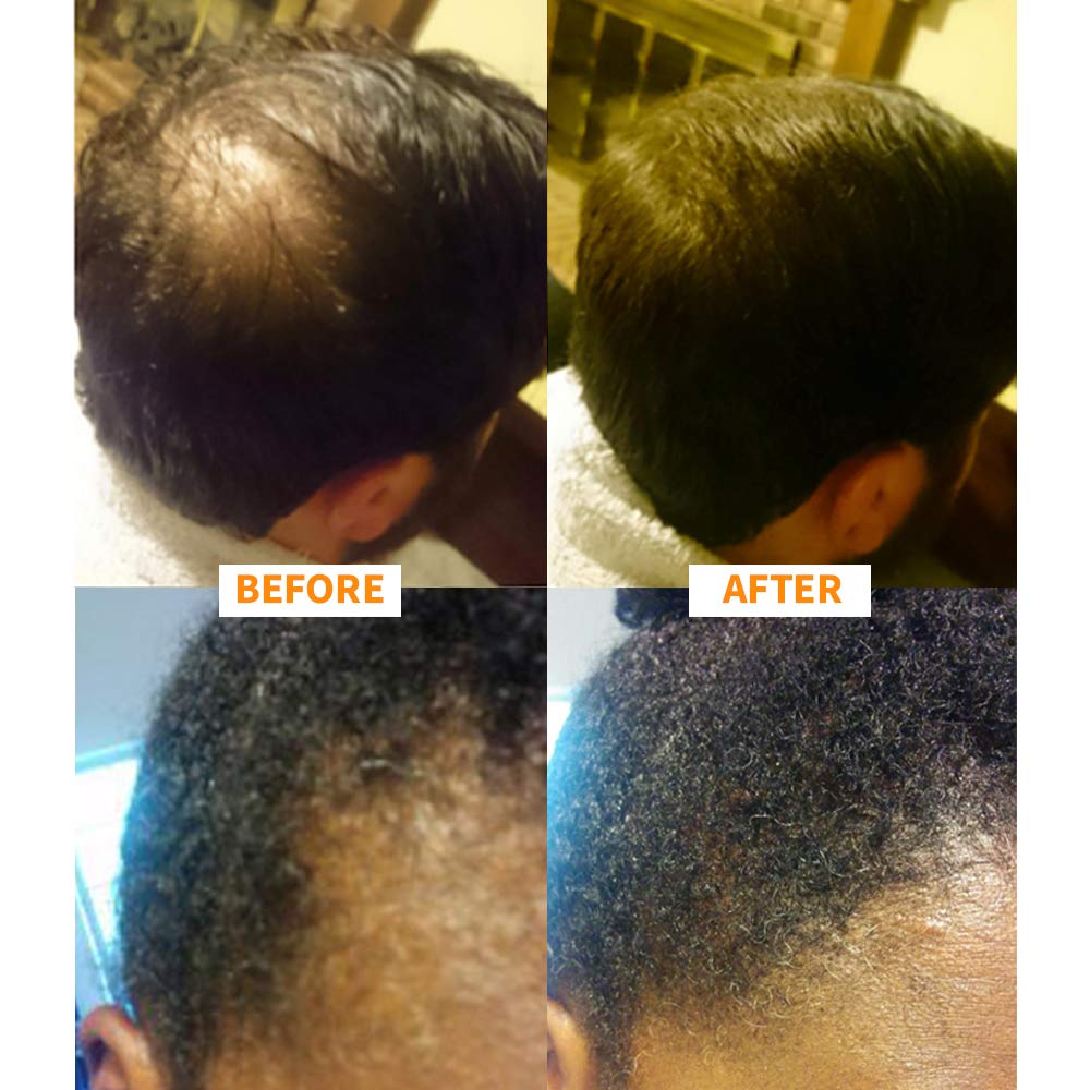 Nor1 Keratin Hair Fibers packaging highlights a 25 gram bottle for daily use