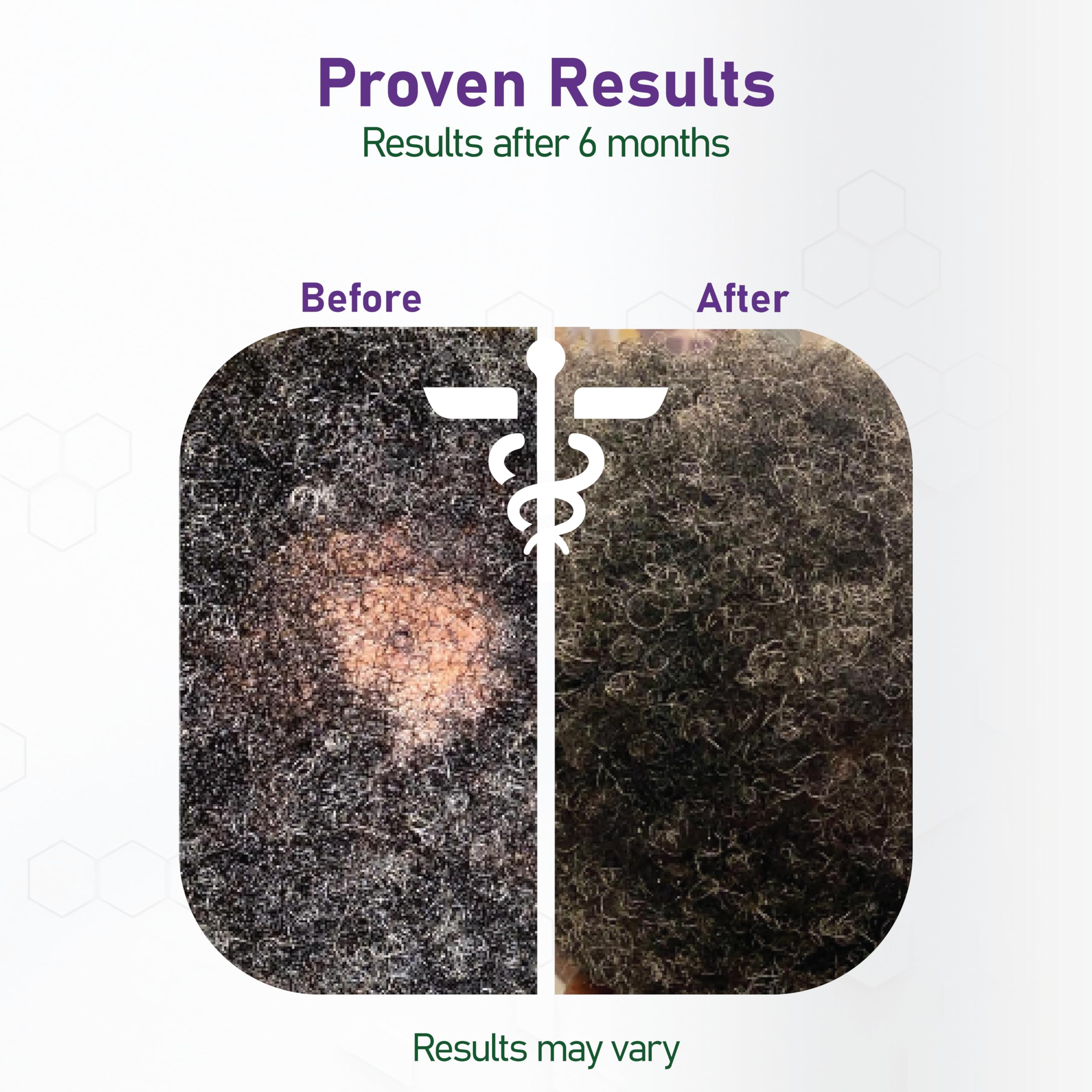 NouriTress daily scalp routine ready for use