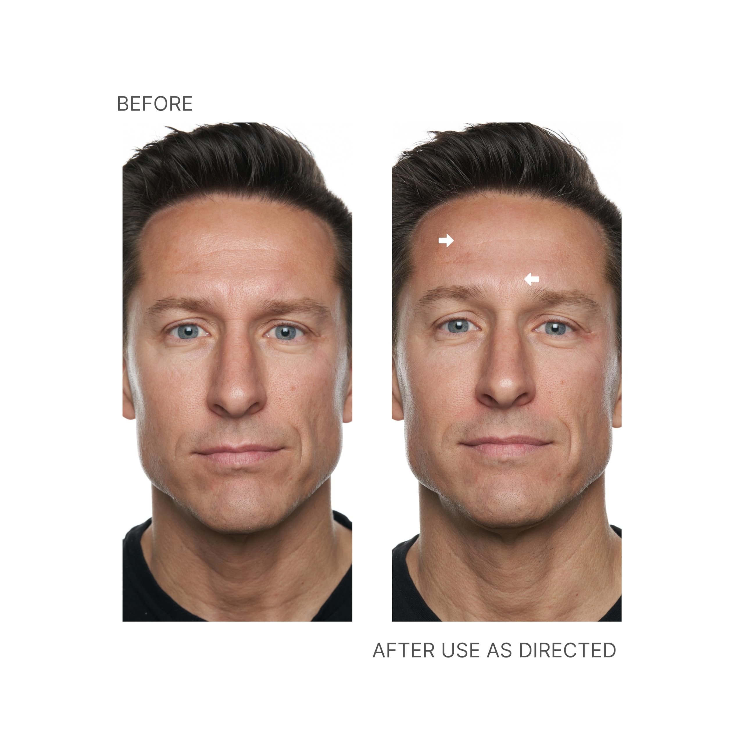 Fragrance-free formula of Nu Skin Face Lift Activator on skin