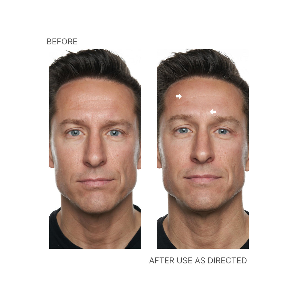 Fragrance-free formula of Nu Skin Face Lift Activator on skin