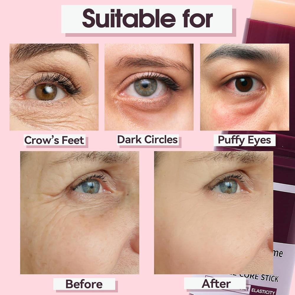 Nuckhuce balm for eyes demonstrates gentle firming support around the eye area.