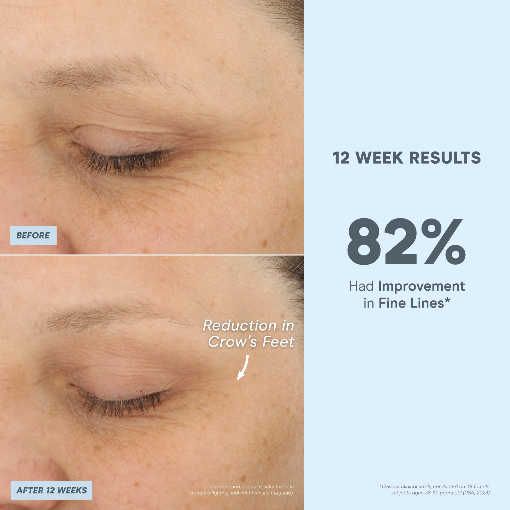 NuFACE Antioxidant Serum blue-light protection icon demonstrates environmental defense