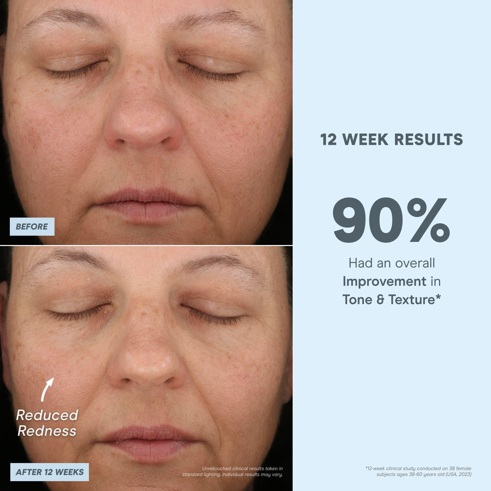 NuFACE Antioxidant Serum in hand for convenient on-the-go boost