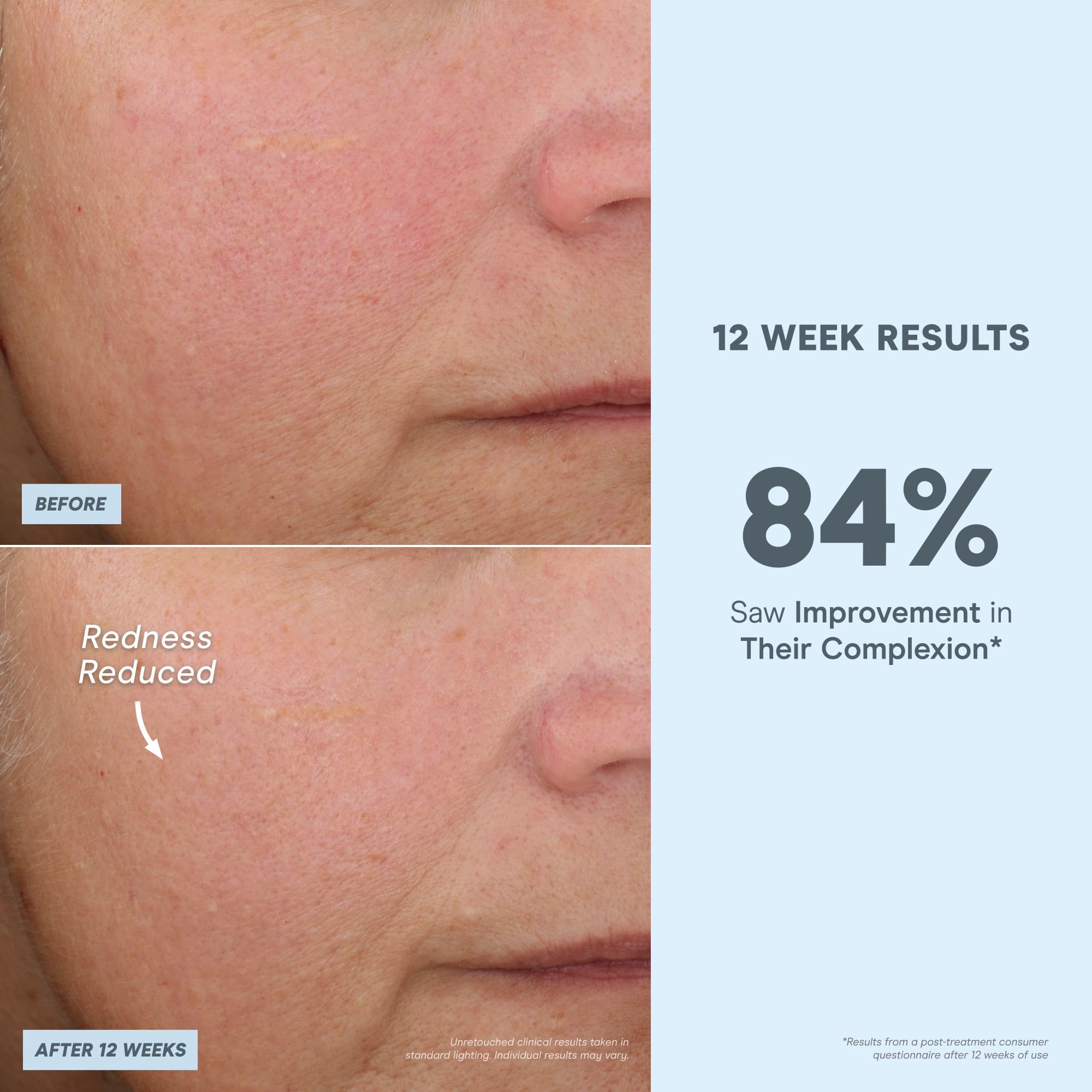 NuFACE Antioxidant Serum ingredient close-up featuring green tea and herbs
