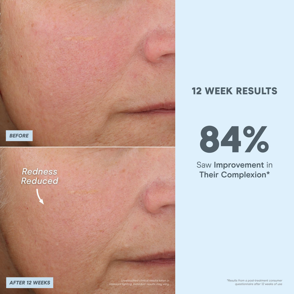 NuFACE Antioxidant Serum ingredient close-up featuring green tea and herbs
