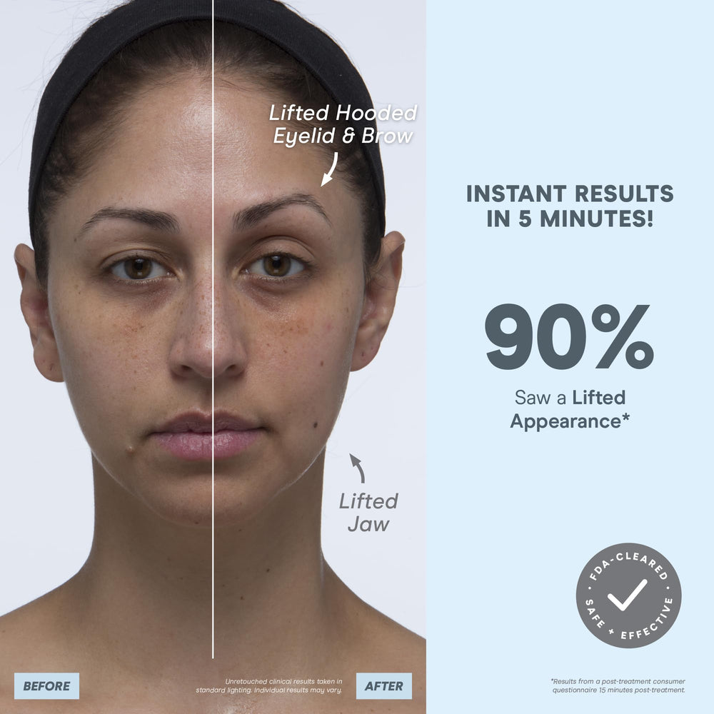 Neck and lower face area during a microcurrent session.