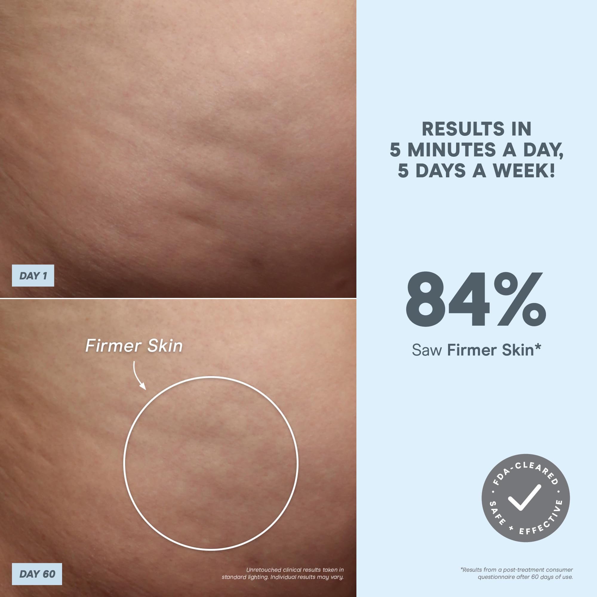 Aqua Gel Activator boosts conductivity for microcurrent sessions.