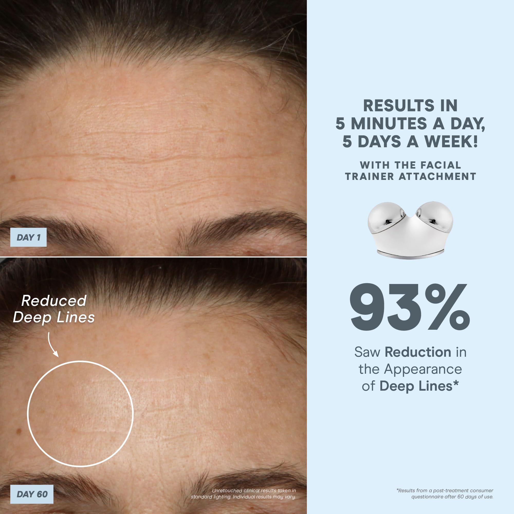 NuFACE Trinity+ app Selfie Tracker screen shows progress and guided treatments.