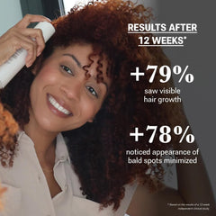 NULASTIN Scalp Serum applied to scalp for targeted thinning areas
