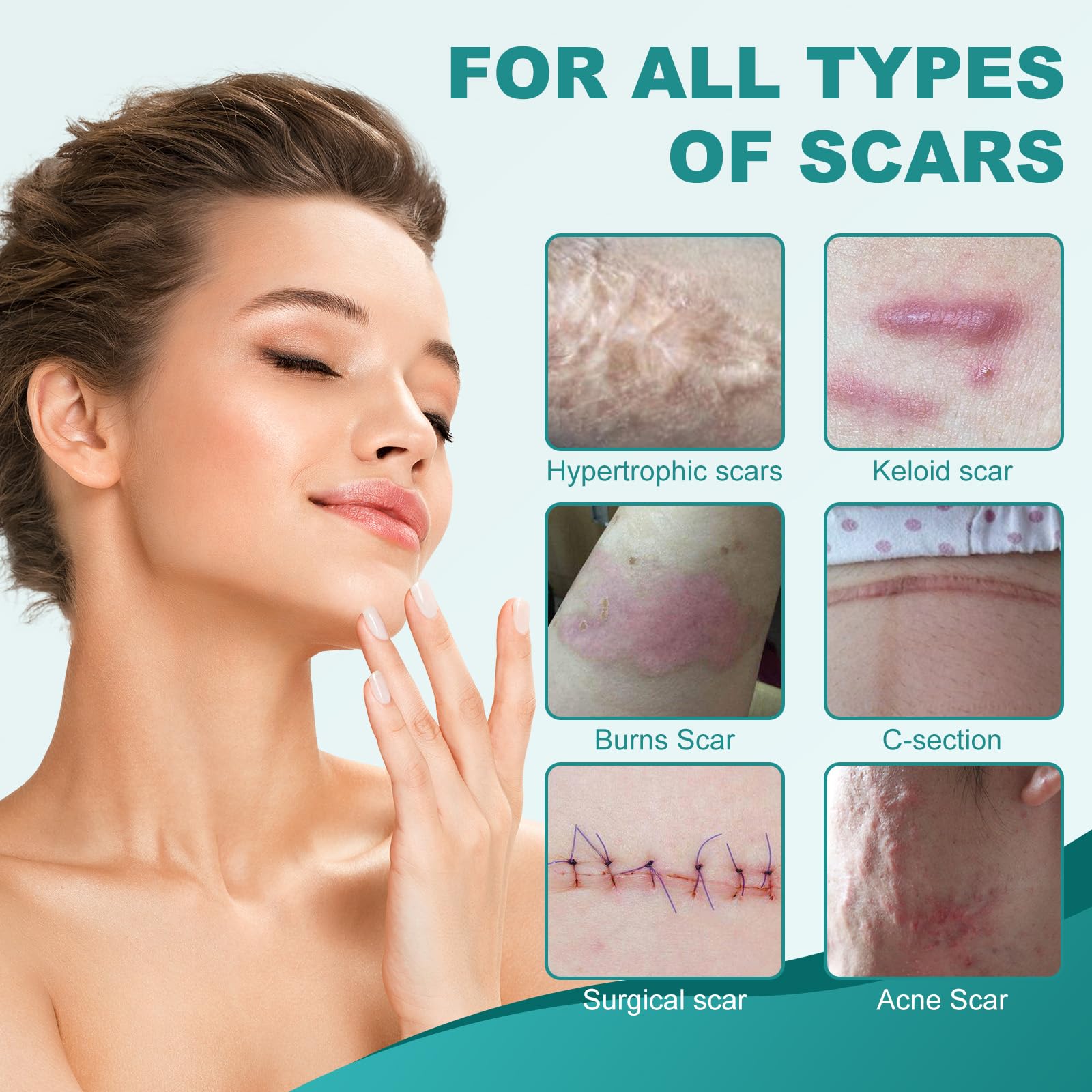 Nullam silicone scar strips used for various scar types and flexibility.