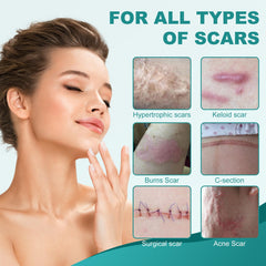 Nullam silicone scar strips used for various scar types and flexibility.