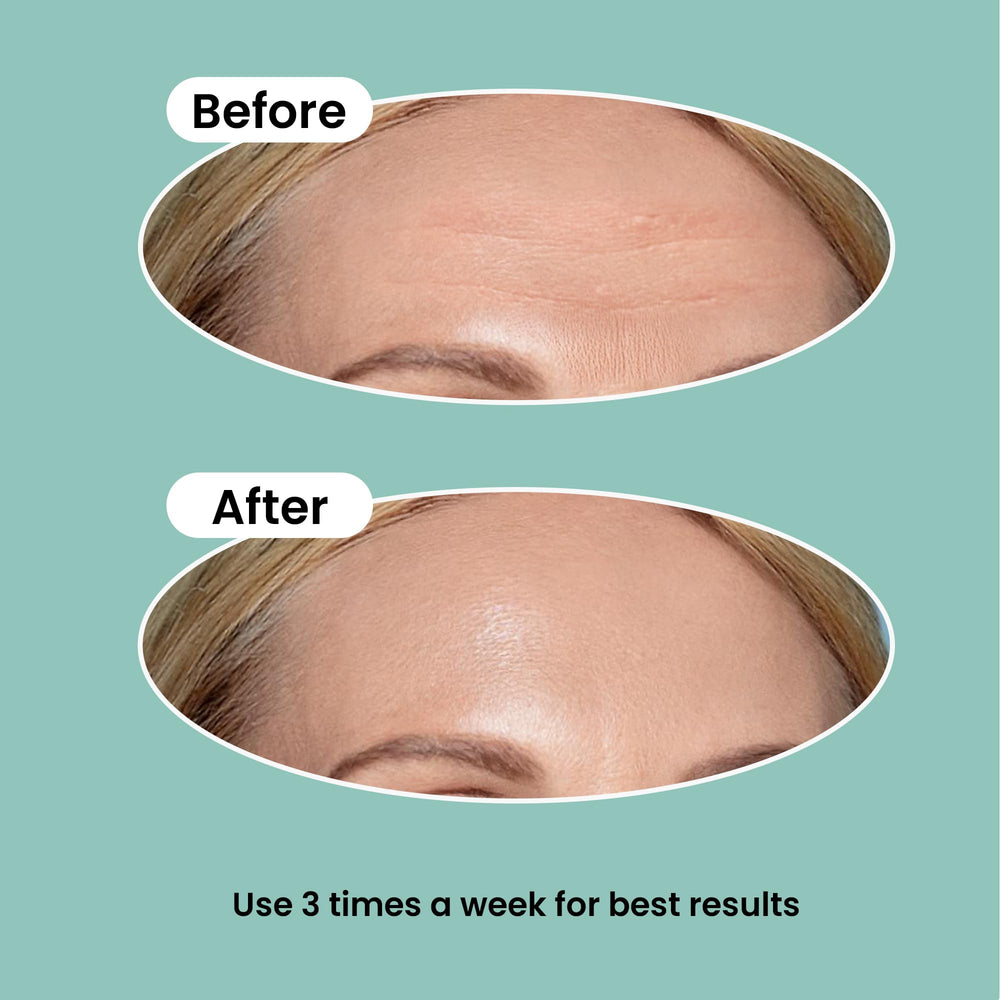 Nurive invisible overnight tape adheres discreetly for lightweight wear.