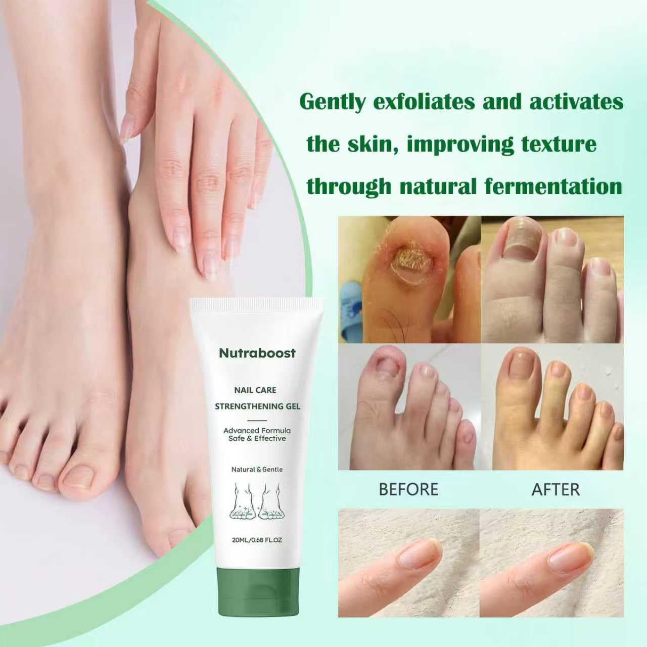 Nutraboost 2-pack nail care set box for convenient home care