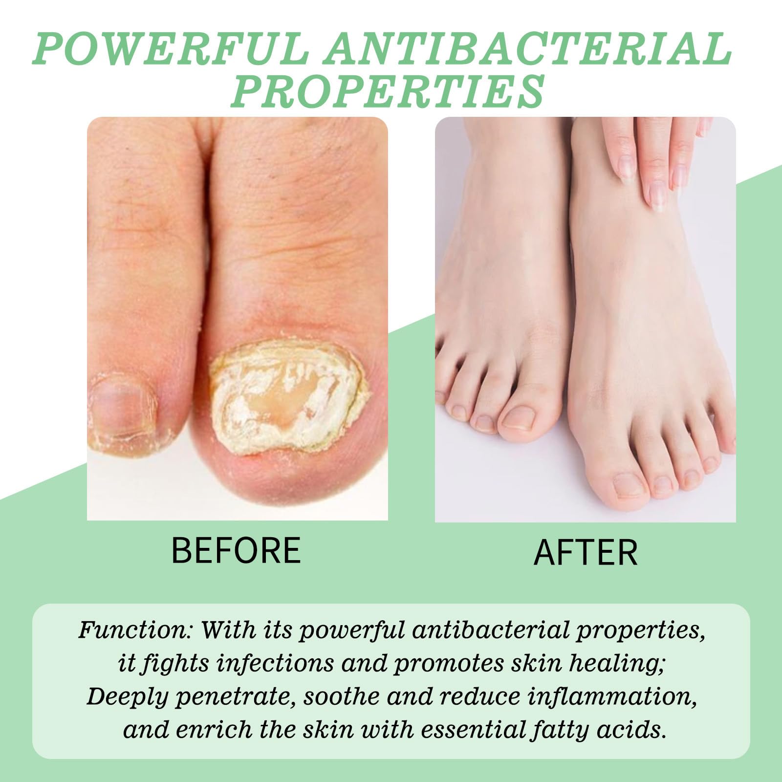 Nutraboost Foot Care Cream closeup suggests soothing care for feet