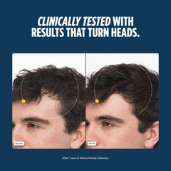 Nutrafol scalp-care prebiotics highlight ingredients supporting microbiome balance.