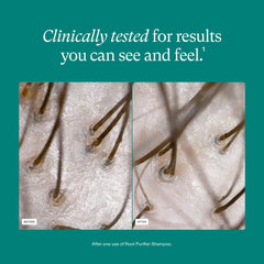 Vegan proteins and prebiotics support scalp health and texture in Nutrafol Shampoo.