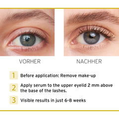 nutricosmetic iGlow eyelash closeup shows rich, healthy-looking lashes.