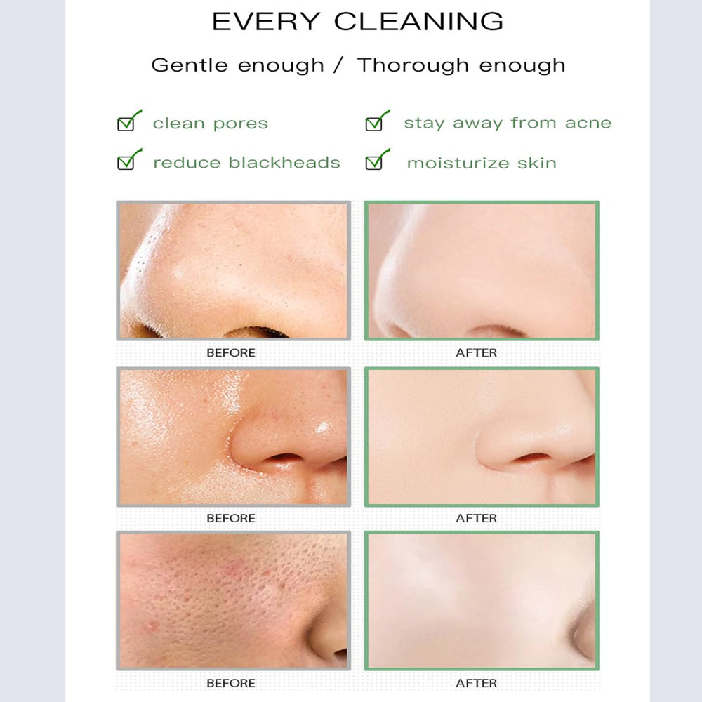 Nvyue Oil-control formula helps balance skin after use.