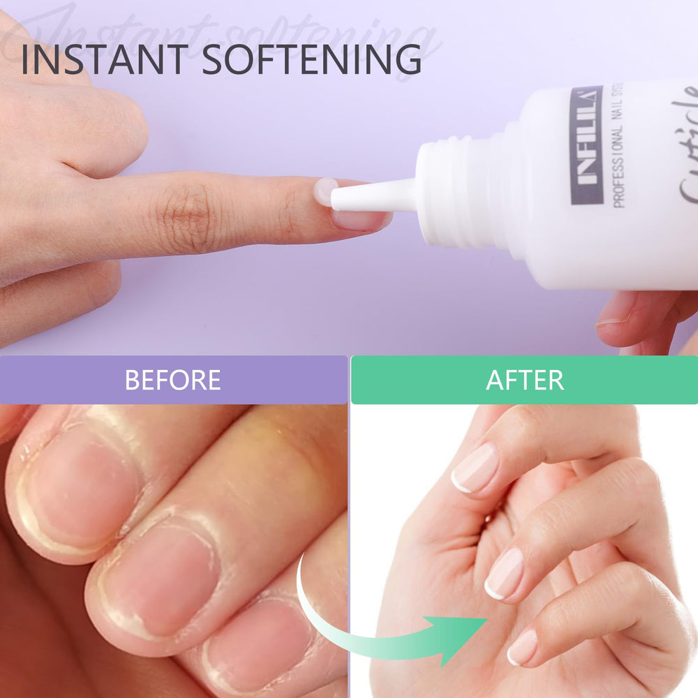 NXJ INFILILA Cuticle Remover being applied to nails for gentle softening.