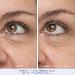 Application on the under-eye area for a refreshed look with Obagi.