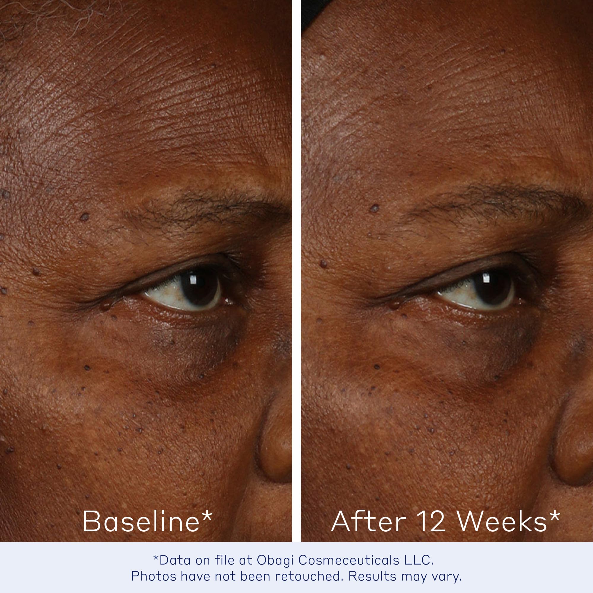 Bi-Mineral Contour graphic illustrates elastin-supporting technology from Obagi.
