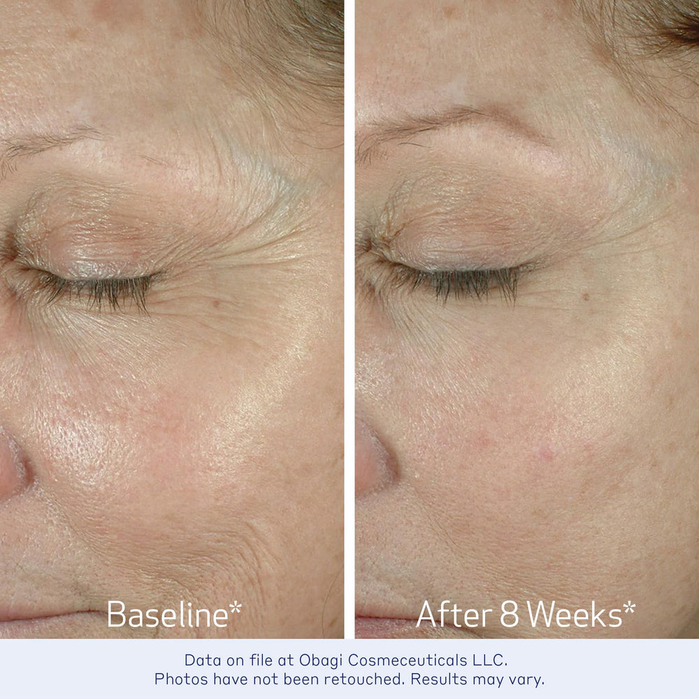 Obagi ELASTIderm Eye Cream dab application, easy spot treatment around the eyes