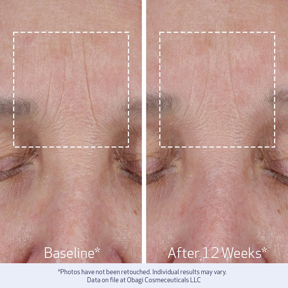 Obagi ELASTIderm packaging box signals clinical-grade skincare heritage.