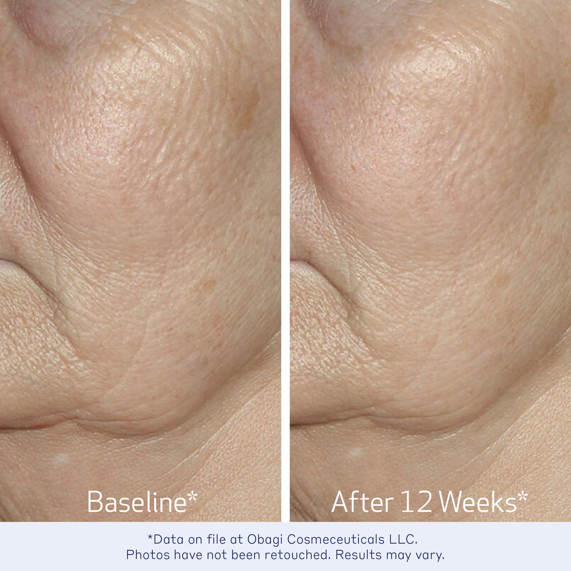 Obagi ELASTIderm serum label detail communicates dermatologist-backed quality.