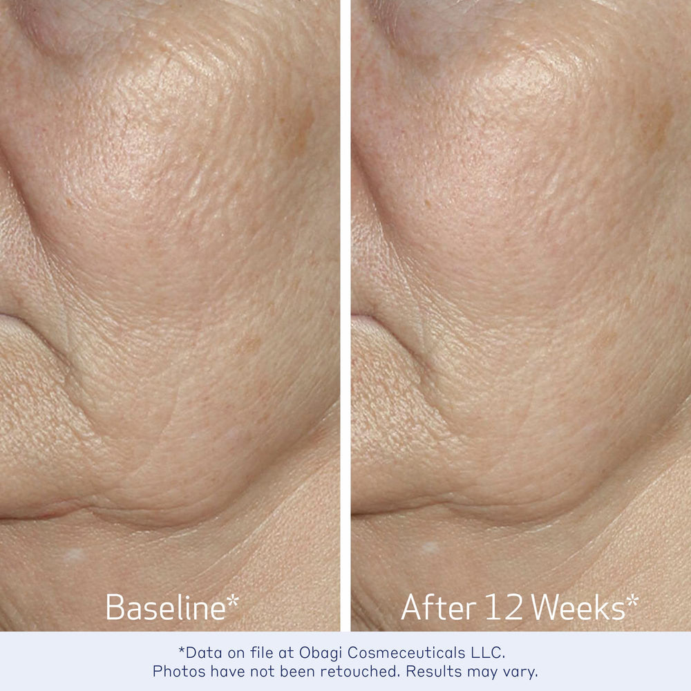 Obagi ELASTIderm serum label detail communicates dermatologist-backed quality.