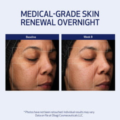 Obagi Medical Retinol + PHA Refining Night Cream application-massage — ideal for gentle nightly routines.