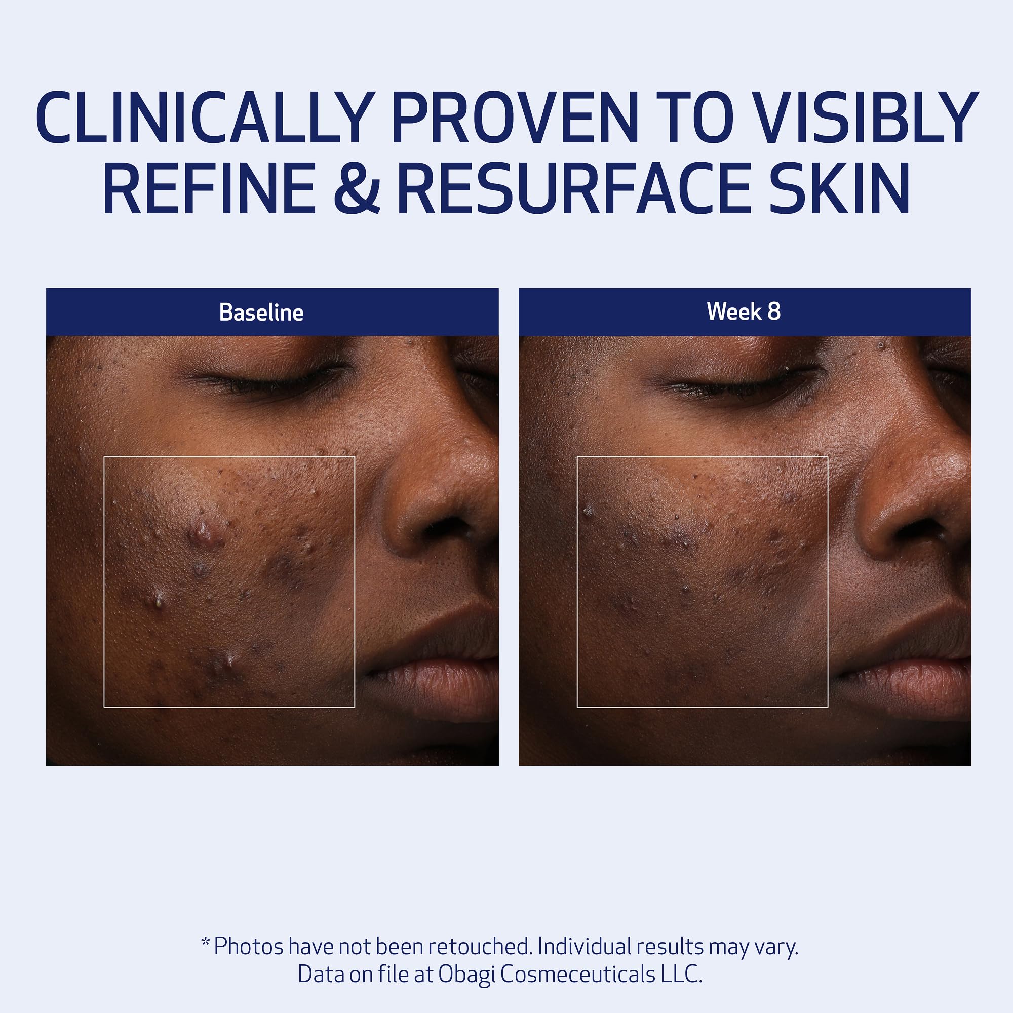 Obagi Medical Retinol + PHA Refining Night Cream night-routine — simple step for evenings.