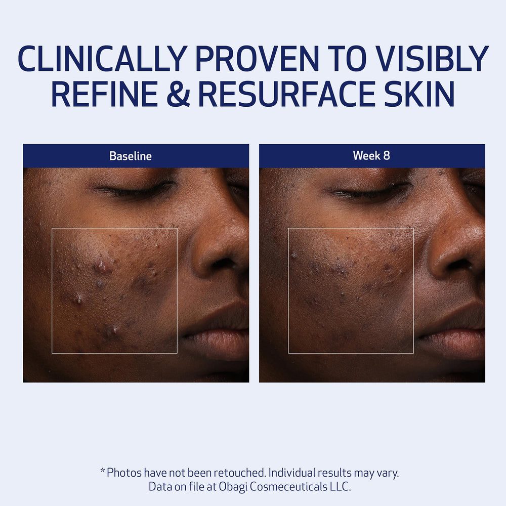 Obagi Medical Retinol + PHA Refining Night Cream night-routine — simple step for evenings.
