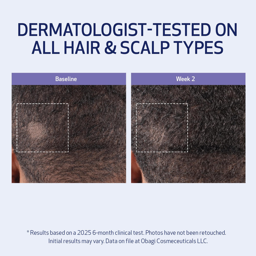 Obagi Nu-Cil BioStim scalp application area showing targeted treatment