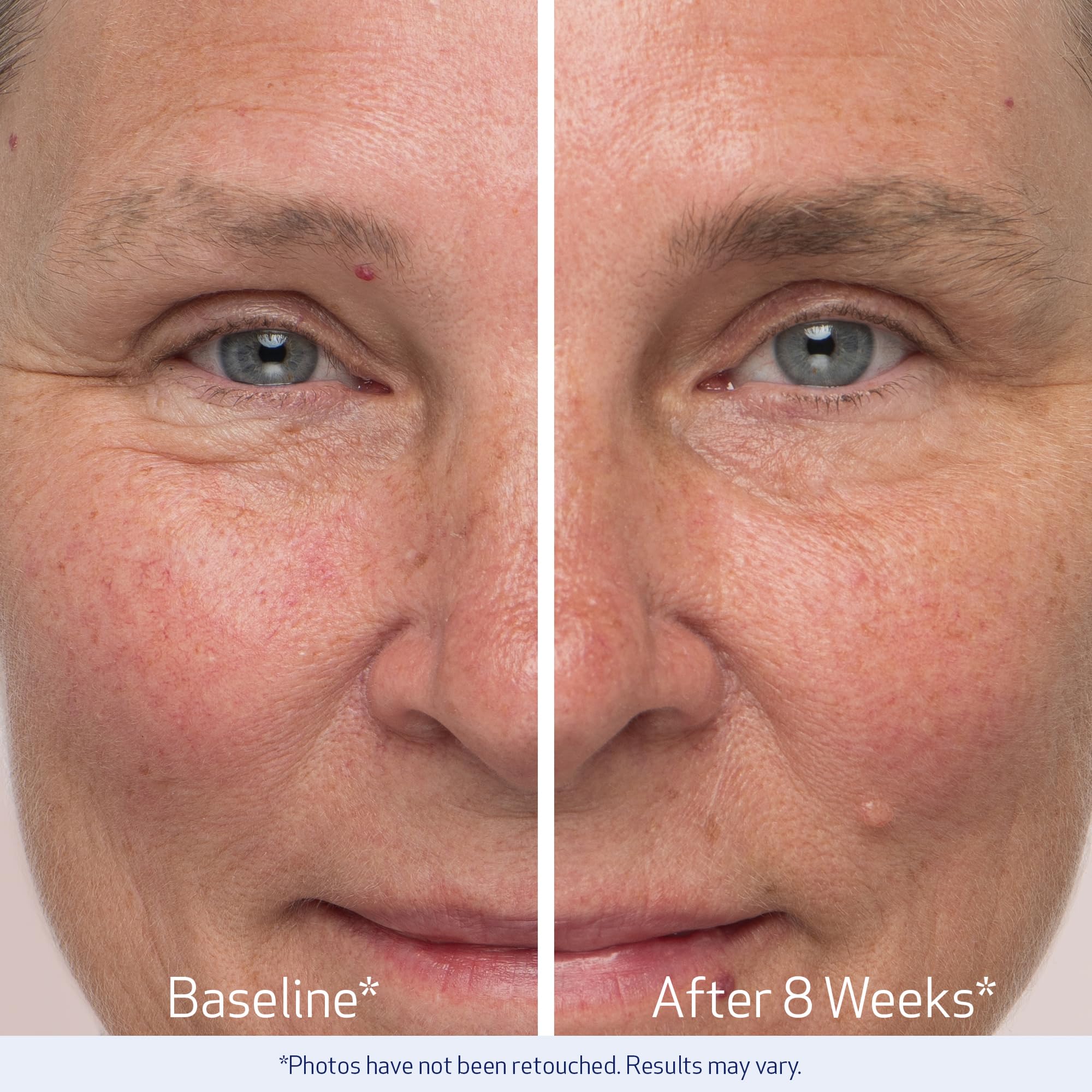 Brow line closeup illustrating precise application area