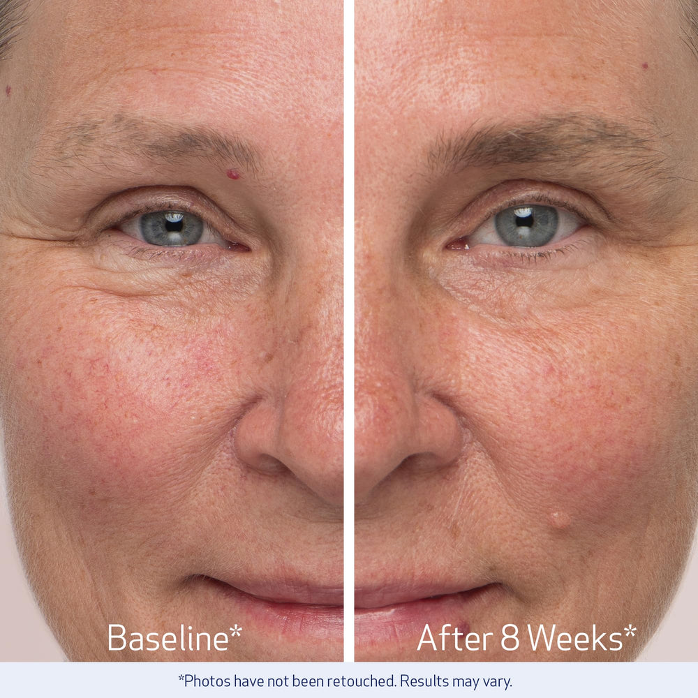 Brow line closeup illustrating precise application area