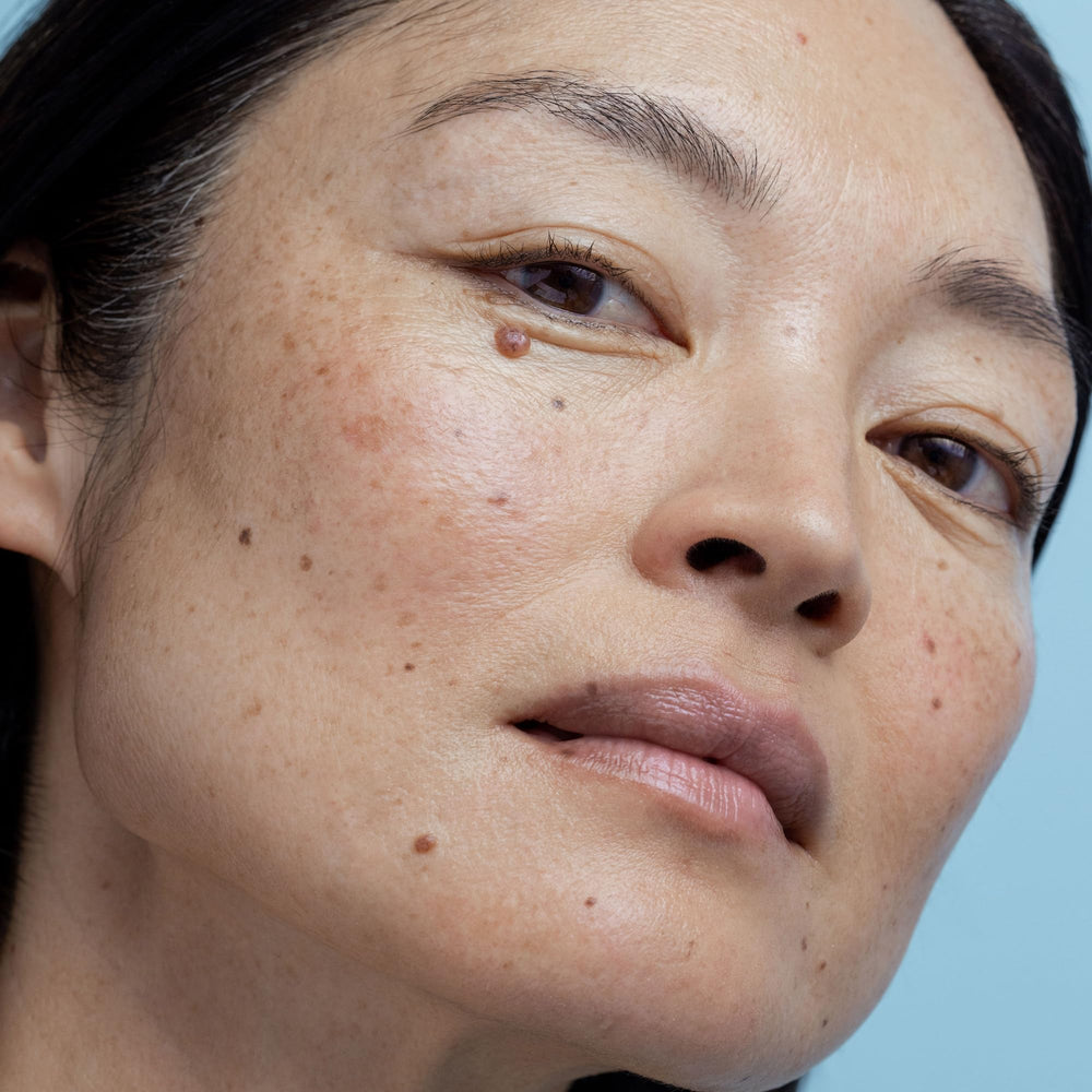 Morning routine scene with Exfoderm Forte prepares skin for daytime regimen.