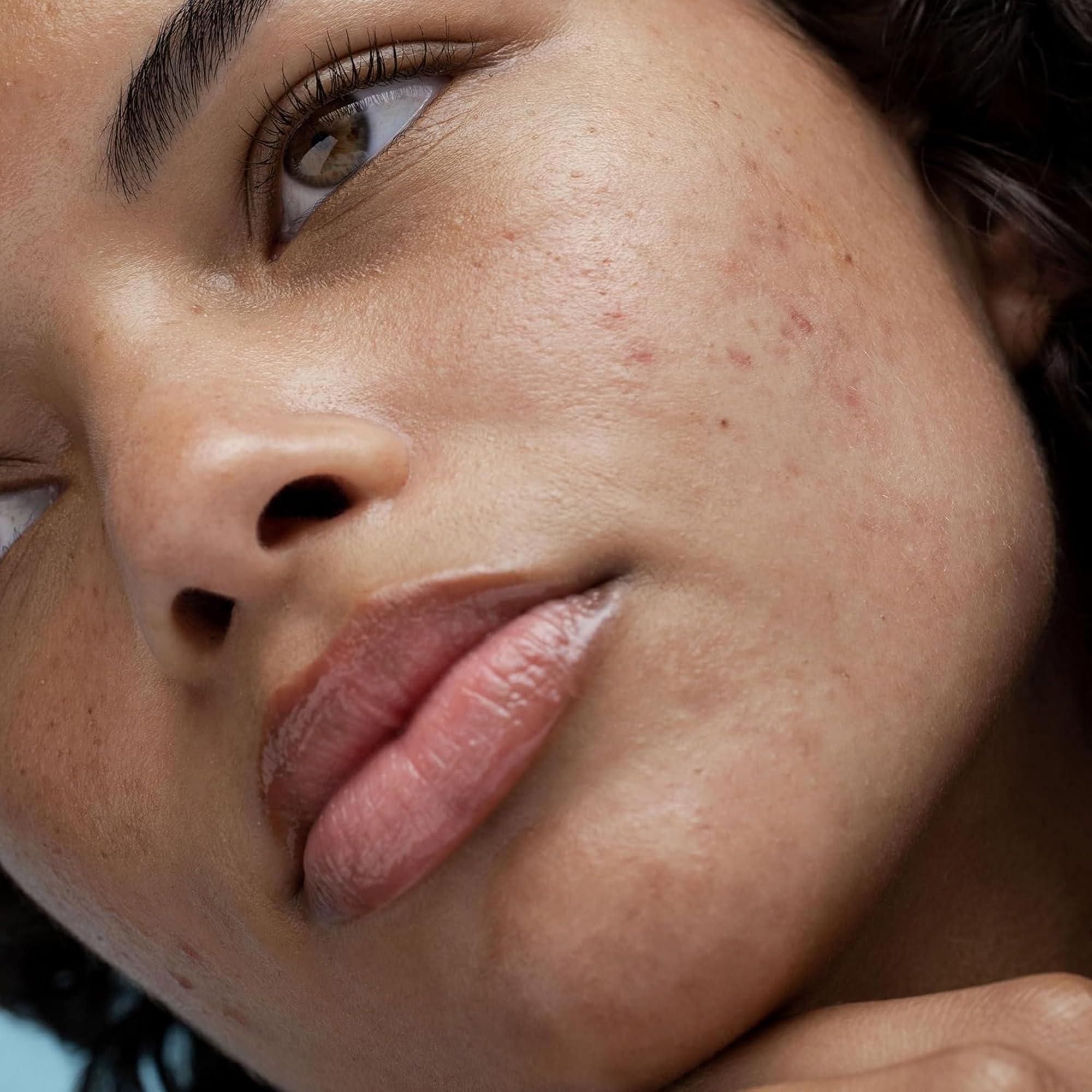 Obagi Rebalance suitable for sensitive skin prone to eczema or rosacea