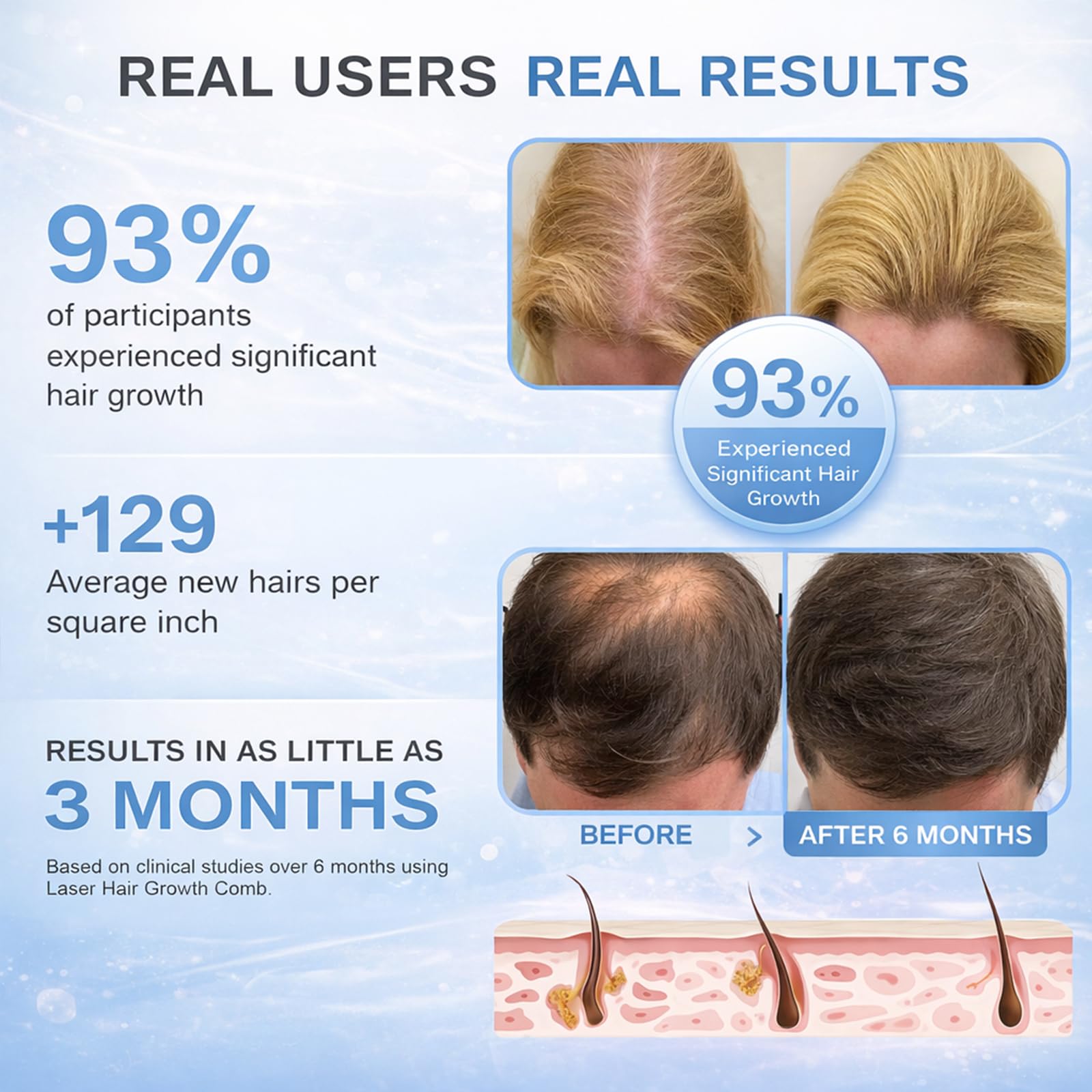 Obiredk Laser Hair Growth Comb packaging presents a gift-ready hair care set.