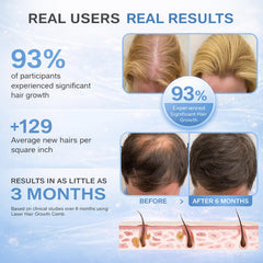 Obiredk Laser Hair Growth Comb packaging presents a gift-ready hair care set.